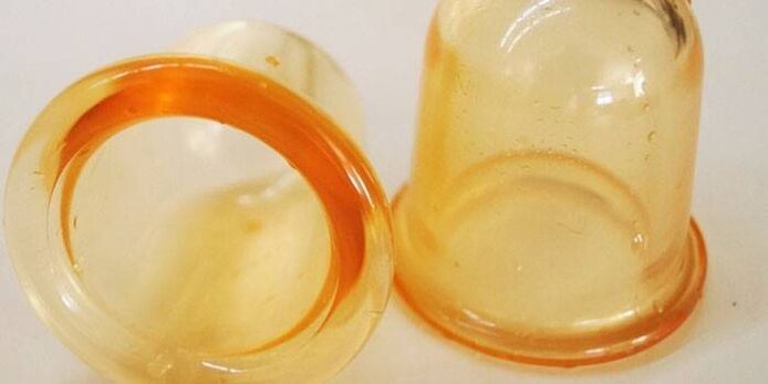 Κύπελλα για τη θεραπεία της προστατίτιδας